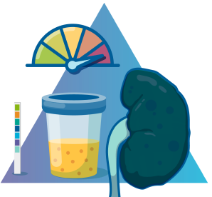 Urine sample container and testing strip, diseased kidney, and multi-color gauge